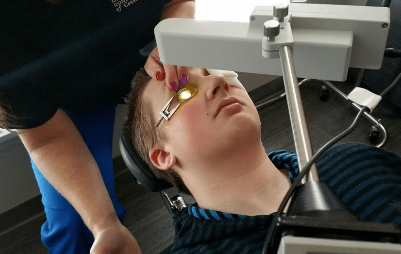 Crosslinking – Chirurgie op der Cornea fir Pathologien